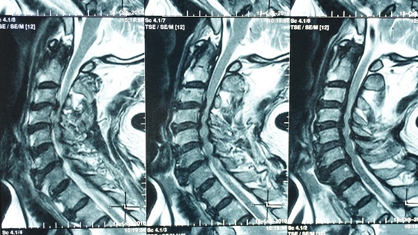 benh vien cih cuu song luat su bi nhieu benh ly ngat ngheo 66f82afe2b4f7