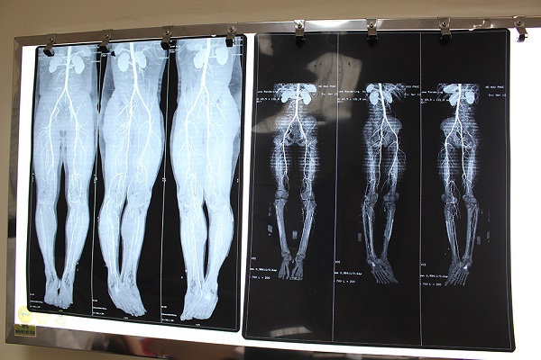 Ảnh chụp phim của bệnh nhân.
