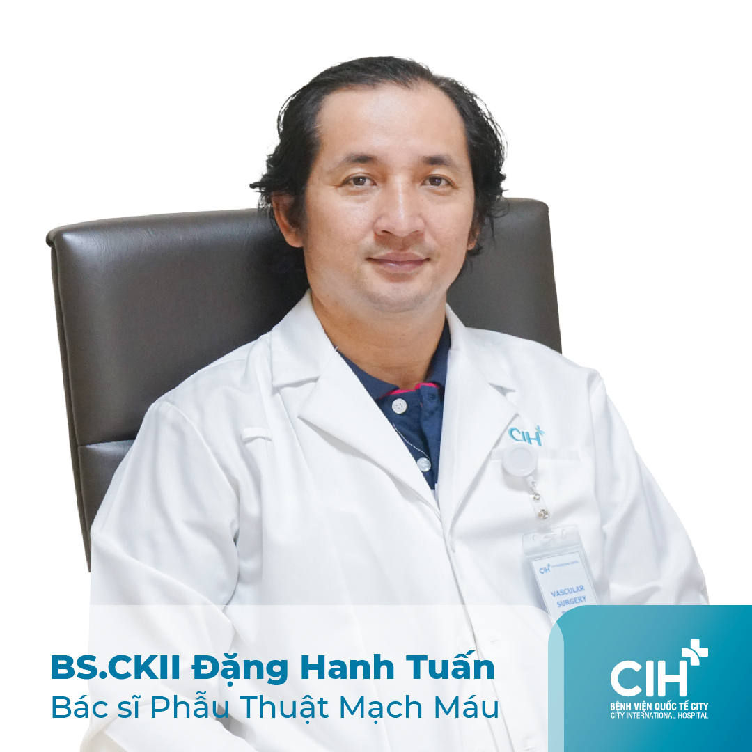 Giãn tĩnh mạch là bệnh gì, triệu chứng, chẩn đoán và điều trị Giãn tĩnh mạch là bệnh gì, triệu chứng, chẩn đoán và điều trị