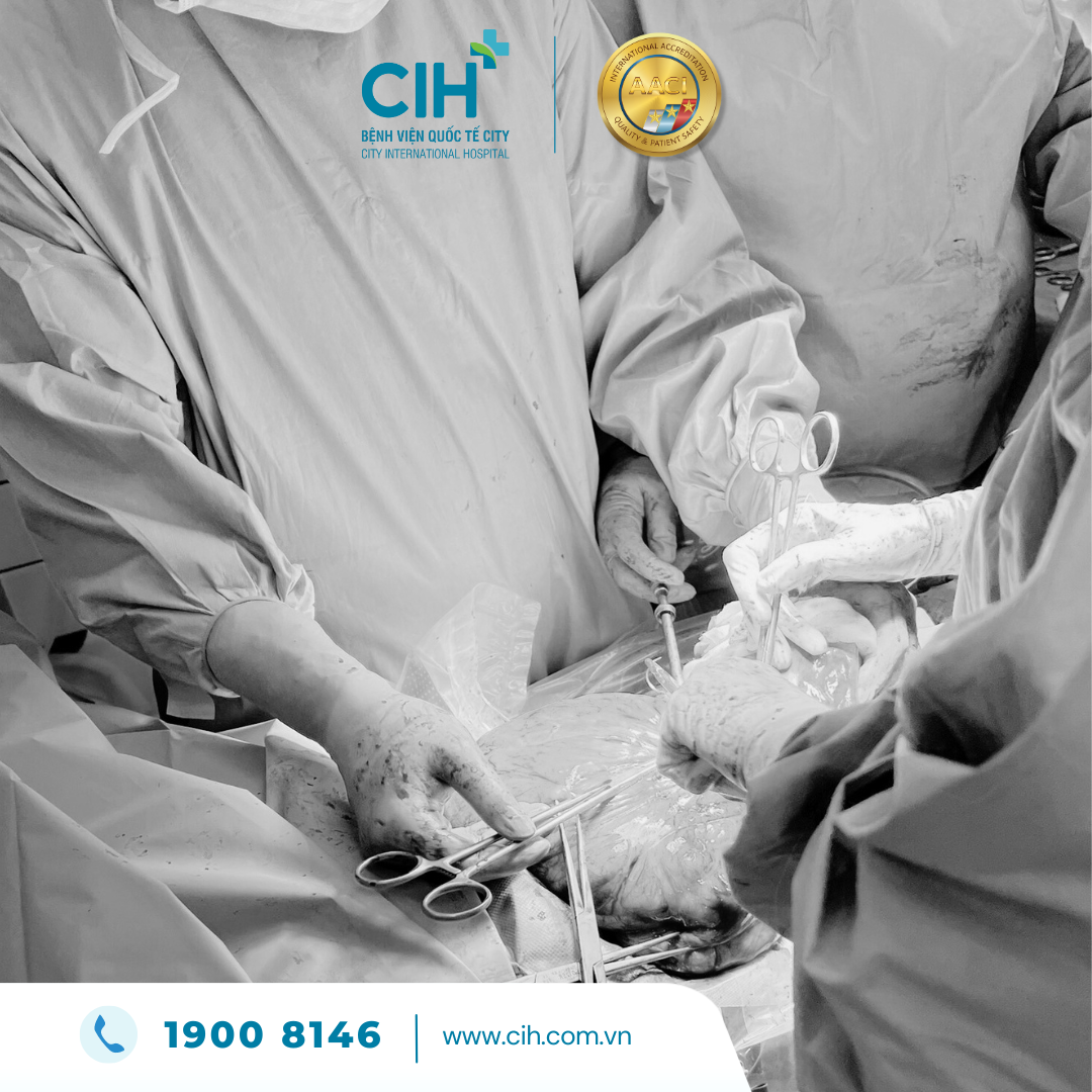 Khối u siêu to 1,5 kg chèn ép thai nhi - phẫu thuật thành công mổ sih và bóc tách