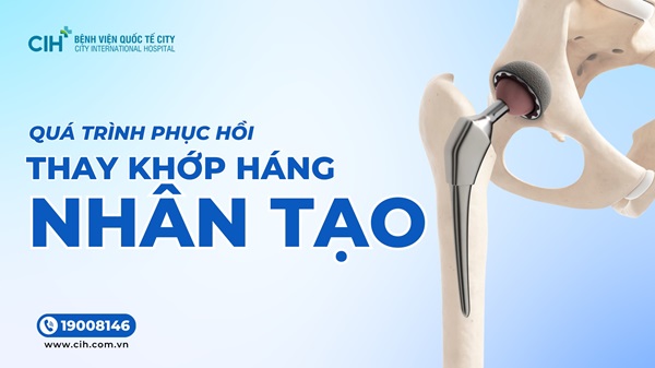 Quá trình phục hồi của bệnh nhân sau phẫu thuật thay khớp háng Quá trình phục hồi của bệnh nhân sau phẫu thuật thay khớp háng