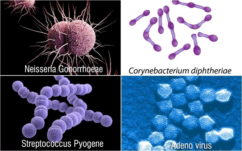 Viêm Kết Giác Mạc